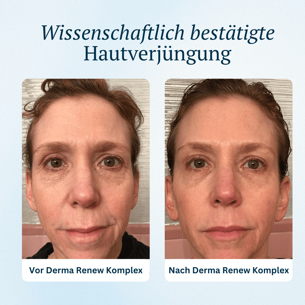 Derma Renew Komplex Prime Abonnement