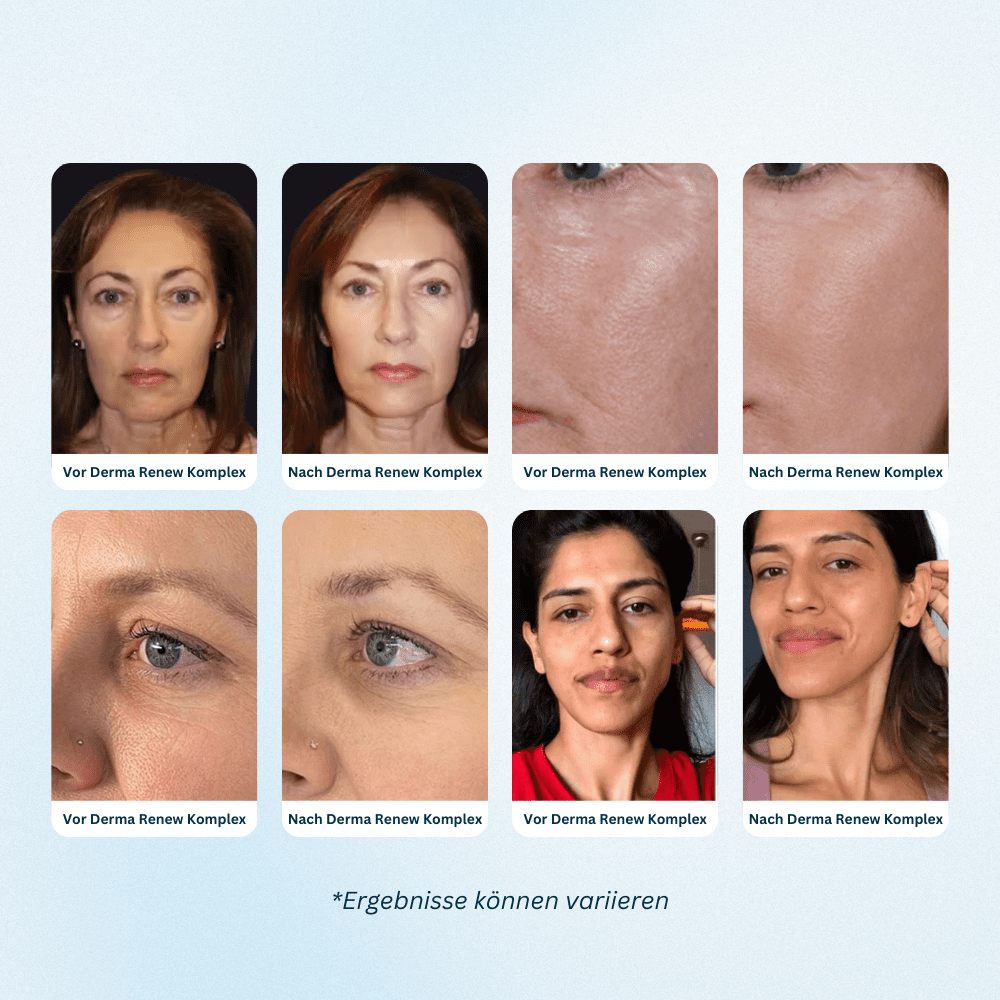 Derma Renew Komplex Prime Abonnement